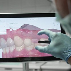 Implant surgeon looking at a digital X-ray of patient’s teeth