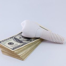 A dental implant sitting on top of a stack of money