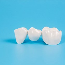 Dental bridge isolated against blue background