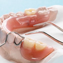 closeup of a partial denture 