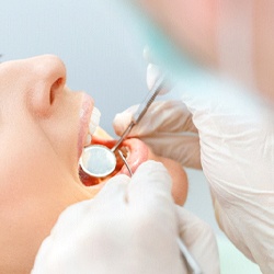 young woman getting dental checkup in Newburyport
