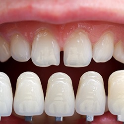 Up close image of gapped teeth
