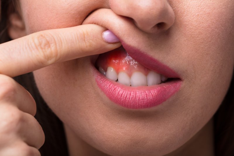 woman with gum disease in Newburyport pointing to her gums 