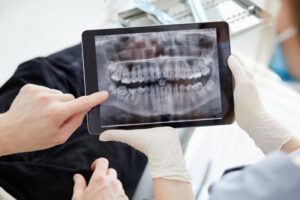 Dental X-ray.